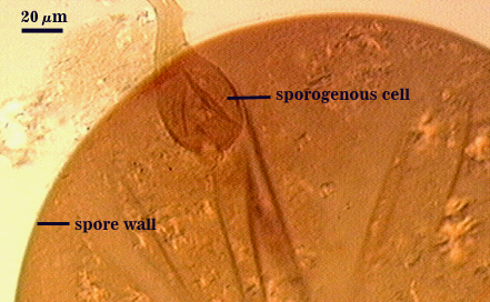Sporogenous cell teardrop shape on stem hypha