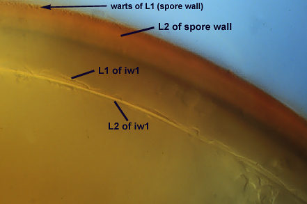 Warts on L1 spore wall granulation