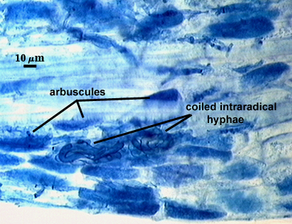 Arbuscule and coiled intraradical hypha