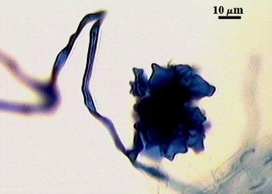 Auxillary cells clumped irregular on hypha stem like