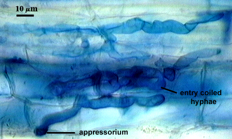 Hypha dark blue organic lines appressorium bulged tip of hypha