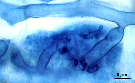 Arbuscule in root soft could of darker blue filling root cell