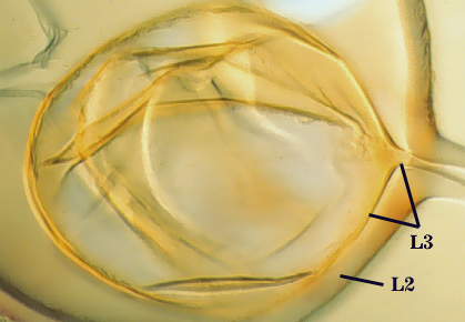 Transparent spore L3 is stemmed oval bag inside of stemmed oval bag which is L2