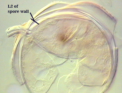 Circle with stem cell well separating from spore