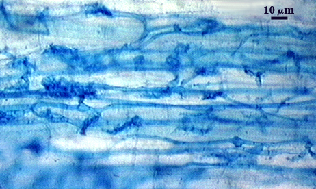 Hyphae dark blue stringy organic lines between cells
