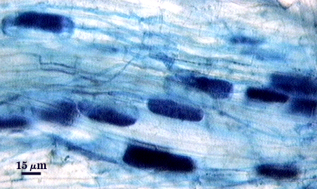 multiple arbuscules dark blue soft rectangles are filled cells