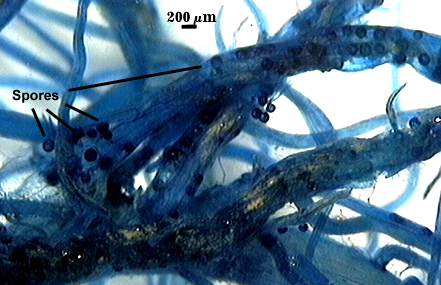 Spores dark blue circles visible against lighter root tissue