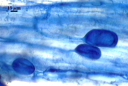 Vesicles dark blue elliptoid bags swelling from hyphae in root