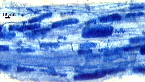 Dark blue soft rectangle in lighter blue root tissue arbuscules dark blue lines betwenn cells hyphae