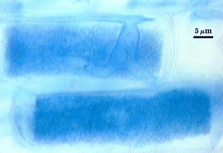 Dark blue soft rectangle in lighter blue root tissue arbuscules