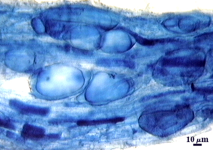 Dark edged circles in lighter root tissue sporulation