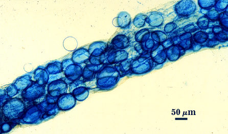 Sporulation in root linear mass of dark blue edged circles