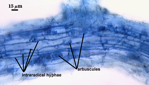 Intra radical hyphae stringy branchy dark lines between lighter root cells