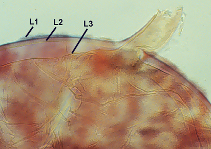 Smashed spore L1 thin outermost L2 thick within L1 L3 thin innermost attachment