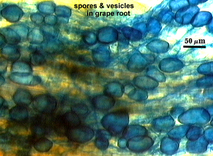 Spores and vesicles dark circles and ovals in root tissue