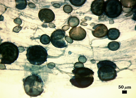 Spores stained dark in root tissue