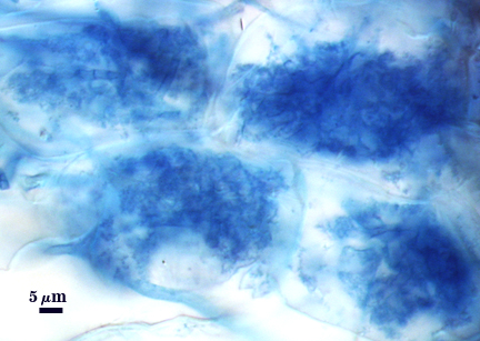 Arbuscule dark blue fungal material fill cell bush like with hyphal stem where entered cell
