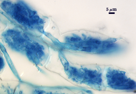 Arbuscule dark blue fungal material fill cell bush like with hyphal stem where entered cell