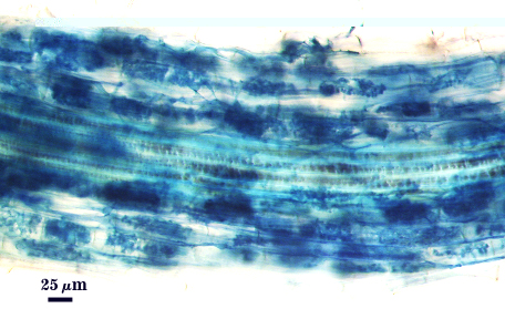 Aarbuscule dark blue fungal material fill cells