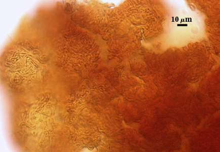 Peridial hyphae spore surface made irregular