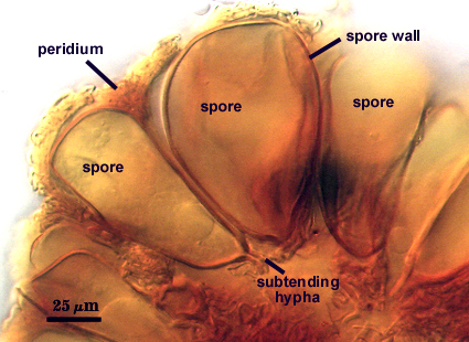 Sporocarp mono hyphal stalk obovate spores subtending hypha visible in peridium fuzz