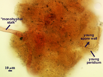 Sporocarp mono hyphal stalk round spores in peridium fuzz