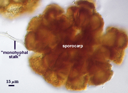 Sporocarp mono hyphal stalk to cluster round spores in peridium fuzz