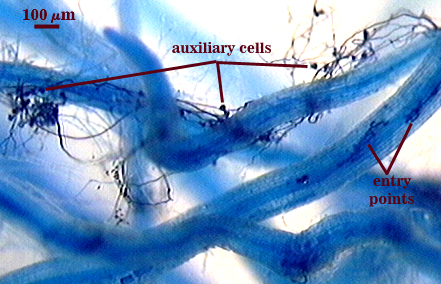 blue stained worm like root fragments auxilary cells dark blue hair like with dark blue specks