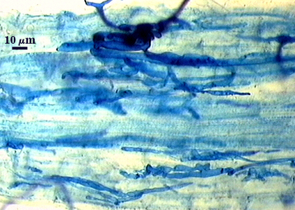 Stained blue structure with branching hyphae