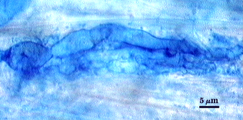 Stained root darker blue branched lines and clusters hyphae and arbuscule