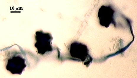 Auxilary cells irregular dark circles on ropy hyphae