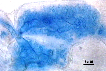 Blue stained arbuscule clear cell shape full of blue stained amorphous blue