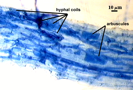 Hyphal coils dark blue indistinct lines in cell arbuscules cell shape filled with dark blue