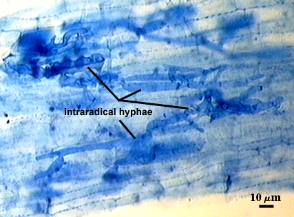 Intraradical hyphae liner and branching dark blue structures in stained root fragment