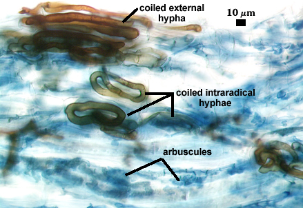 Coiled hyphae external and internal stained black brown arbuscules indistinct dark patches