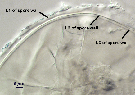 L1, L2 and L3 all adherent. L3 and L2 form line around edge and L1 outer irregular