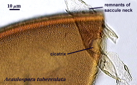 Acaulospora tuberenlata saccule neck