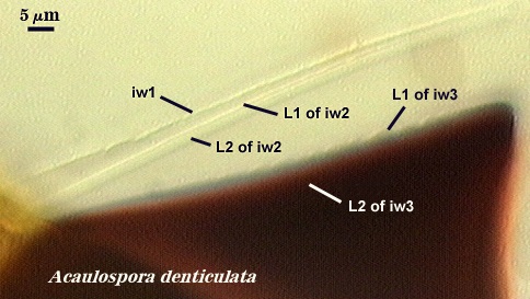 Acaulospora denticulata flexible inner wall