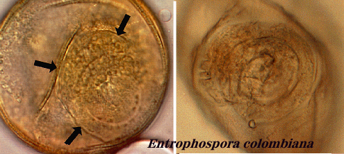 Entrophospora columbiana germination orb