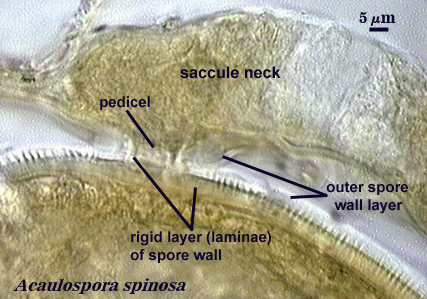 Acaulospora spinosa spore wall
