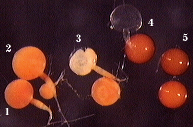 Immature light orange spores and mature darker red brown spores