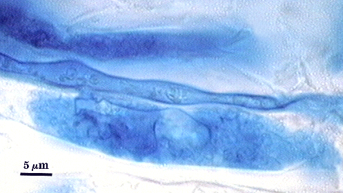 Arbuscule dark blue in cortical cells