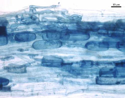 Mycorrhizae in corn oblong ovals navy outlined from stain