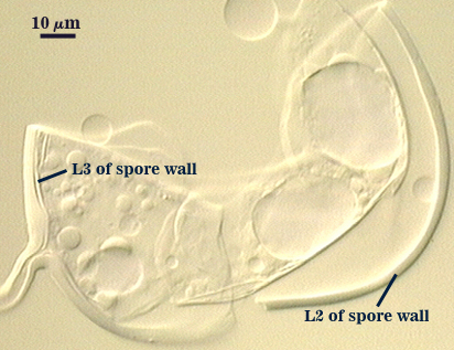 Membranous wall