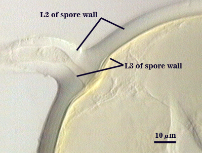 Amorphous plug, a septum, an inner sublayer of the laminate layer of the spore wall