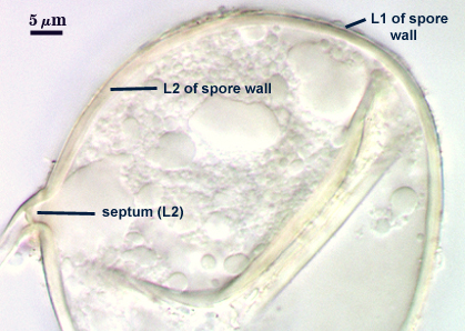 Amorphous plug, a septum, an inner sublayer of the laminate layer of the spore wall