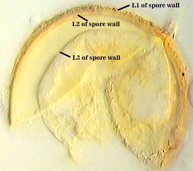 Membranous wall