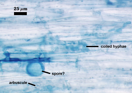Vesicle sample photo
