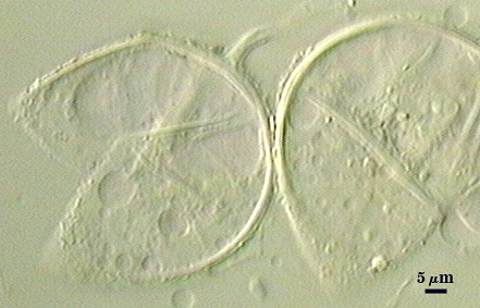 Loose aggregates of 2-3 spores; subcellular structure is identical to that of Glomus species