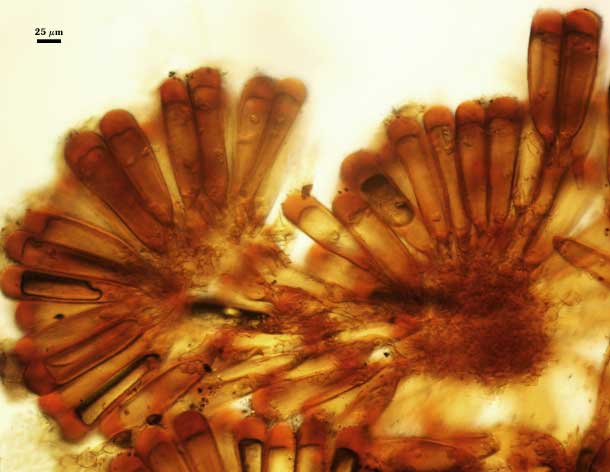 F. mosseae, an organized sporocarp of G. clavisporum with spores formed around a central hyphal plexus